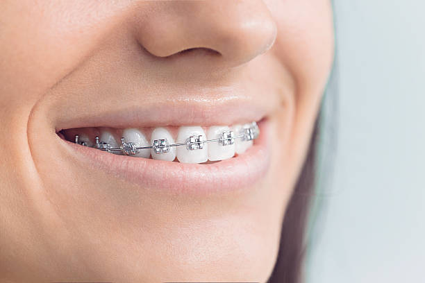 Best Traditional Braces  in Bling, AR